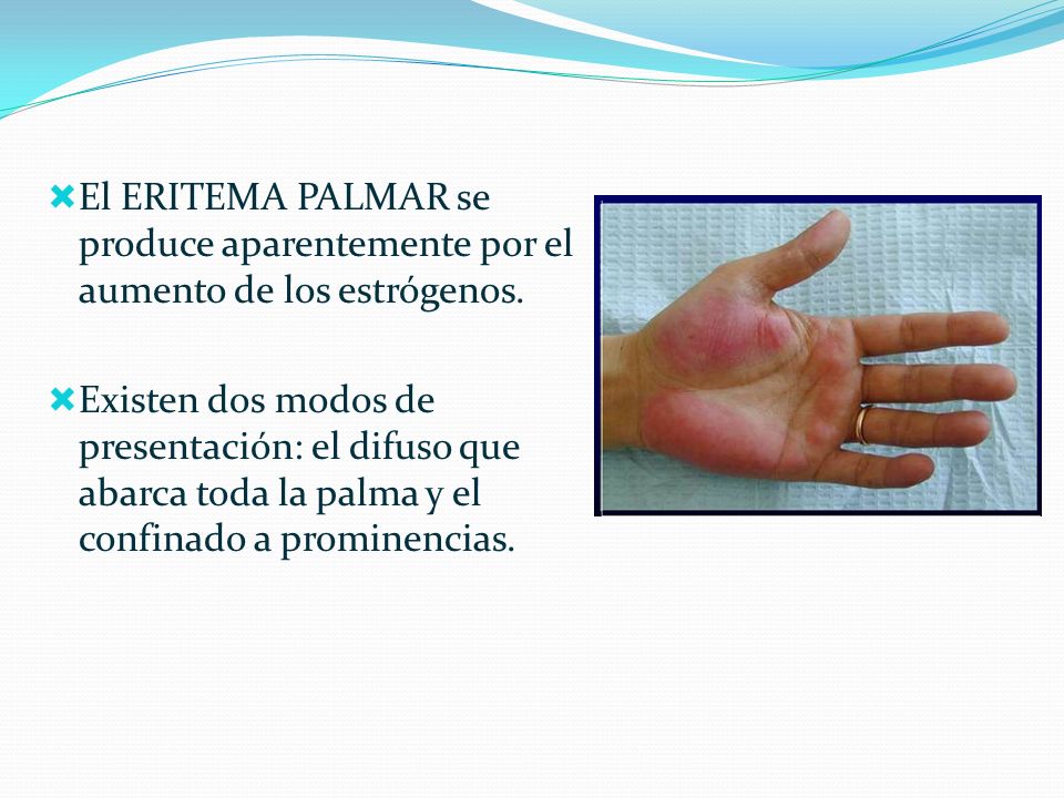 El modo fácil del aumento del pene